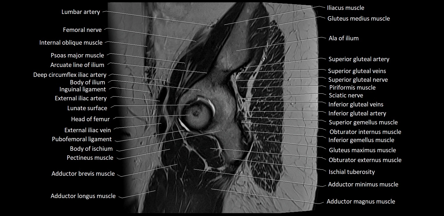 Sagittal cross sectional anatomy of female pelvis (MRI 3T) image 1.webp